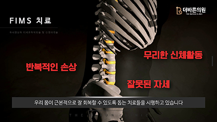 이미지명