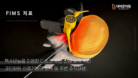 이미지명