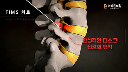 이미지명